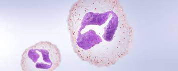 WBC's more than the standard limit